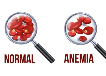 Anaemia in pregnancy doctor in Meerut